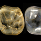 Teeth from the DAN5 cranium.